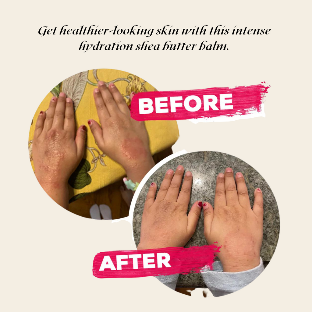 Gluten-Free Body Balm for Dry, Sensitive Skin – Nut-Free, Vegan & Ultra-Rich